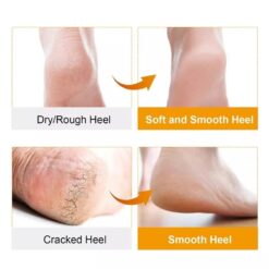 Alternative view of Silicone Gel Socks