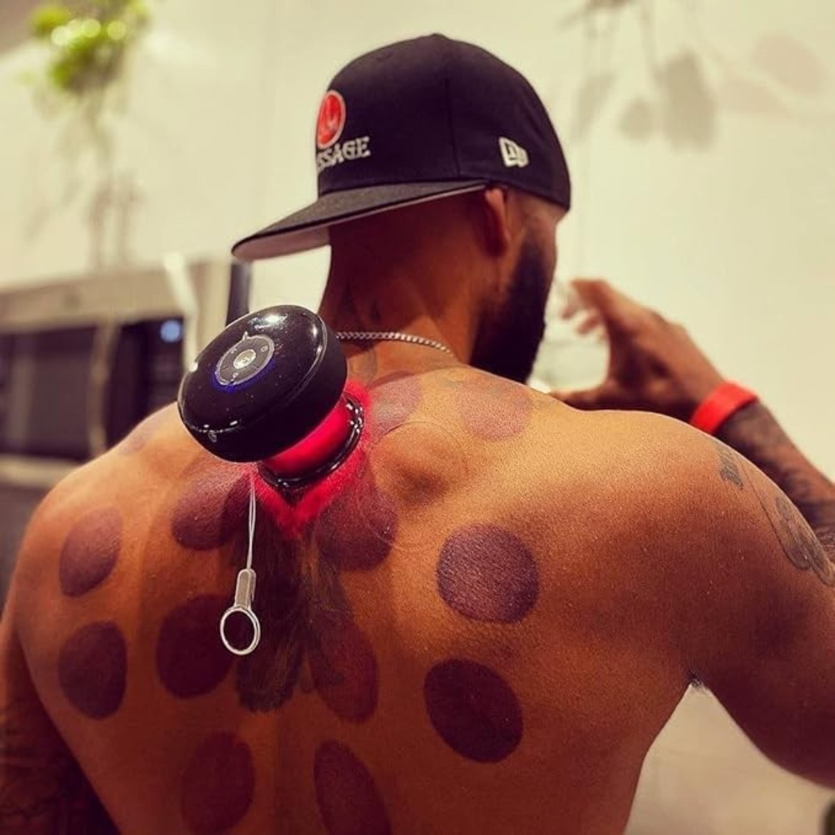 Hijama Electric Cupping Therapy - Image 4